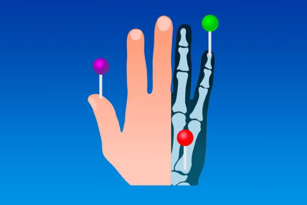 e-Anatomy d'IMAIOS : atlas interactif d'anatomie humaine